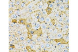 Immunohistochemistry of paraffin-embedded Rat liver using OXA1L Polyclonal Antibody at dilution of 1:100 (40x lens). (OXA1L 抗体)