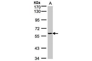 Western Blotting (WB) image for anti-Tyrosyl-tRNA Synthetase (Yars) (AA 357-520) antibody (ABIN467437) (YARS 抗体  (AA 357-520))