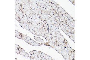 Immunohistochemistry (IHC) image for anti-Dystrophin (DMD) (AA 346-635) antibody (ABIN1679546)