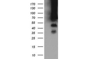 Image no. 8 for anti-tRNA Methyltransferase 2 Homolog A (TRMT2A) antibody (ABIN1501515) (TRMT2A 抗体)