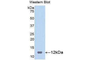 Western Blotting (WB) image for anti-S100 Calcium Binding Protein B (S100B) (AA 1-92) antibody (ABIN1860490) (S100B 抗体  (AA 1-92))