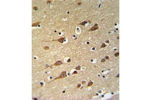 Immunohistochemistry (Paraffin-embedded Sections) (IHC (p)) image for anti-Glutamic-Oxaloacetic Transaminase 1, Soluble (Aspartate Aminotransferase 1) (GOT1) (AA 352-381), (C-Term) antibody (ABIN650770)