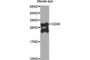 Western Blotting (WB) image for anti-CD40 (CD40) antibody (ABIN3020704) (CD40 抗体)