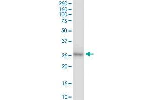CDX1 monoclonal antibody (M01), clone 2D8.