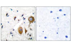 Immunohistochemical analysis of paraffin-embedded human brain tissue using GluR8 antibody (ABIN5976415). (GRM8 抗体  (C-Term))