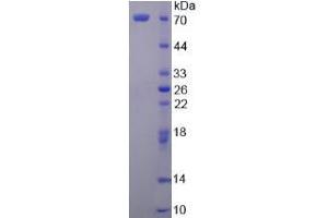 SDS-PAGE analysis of Secretogranin II Protein. (SCG2 蛋白)