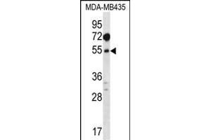 T1A Antibody (N-term) (ABIN656632 and ABIN2845877) western blot analysis in MDA-M cell line lysates (35 μg/lane). (MAT1A 抗体  (N-Term))