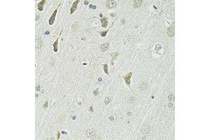 Immunohistochemistry (Paraffin-embedded Sections) (IHC (p)) image for anti-Solute Carrier Family 1 (Glutamate/Neutral Amino Acid Transporter), Member 4 (SLC1A4) (AA 140-220) antibody (ABIN6147872)