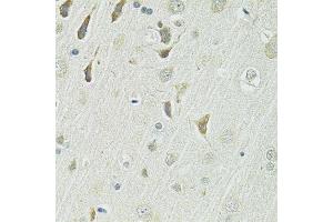 Immunohistochemistry of paraffin-embedded rat brain using SLC1A4 antibody. (SLC1A4 抗体  (AA 140-220))