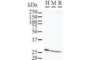 Detection of FBP3 by Western Blot. (FKBP3 抗体)