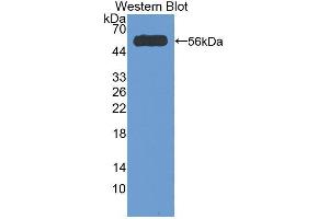 Western blot analysis of the recombinant protein. (Corin 抗体  (AA 807-1038))