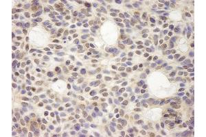 anti-Discs, Large (Drosophila) Homolog-Associated Protein 5 (DLGAP5) (AA 200-250) antibody