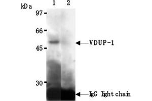 Western Blotting (WB) image for anti-Thioredoxin Interacting Protein (TXNIP) antibody (ABIN567793) (TXNIP 抗体)