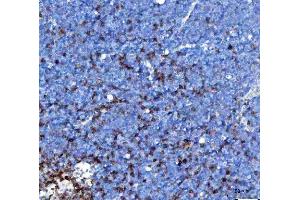 IHC analysis of TCR alpha/TRAC using anti-TCR alpha/TRAC antibody (ABIN6719654). (TRAC 抗体  (AA 1-114))