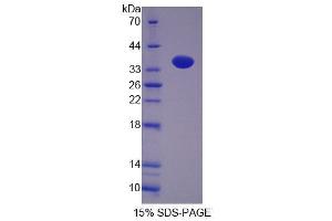 SDS-PAGE analysis of Rat NP Protein. (PNP 蛋白)
