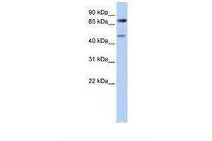 Image no. 1 for anti-Denticleless E3 Ubiquitin Protein Ligase Homolog (DTL) (AA 182-231) antibody (ABIN6738232) (CDT2/RAMP 抗体  (AA 182-231))