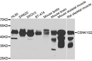 Western blot analysis of extracts of various cell lines, using CSNK1G2 antibody (ABIN4903389) at 1:1000 dilution. (Casein Kinase 1 gamma 2 抗体)