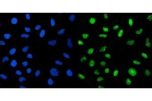 IF analysis of CRTC3 using anti-CRTC3 antibody (ABIN7599779).