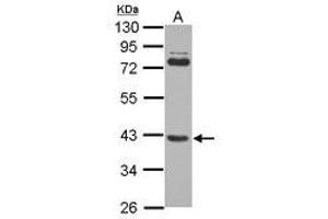 Image no. 2 for anti-SET and MYND Domain Containing 3 (SMYD3) (AA 21-416) antibody (ABIN1501007) (SMYD3 抗体  (AA 21-416))