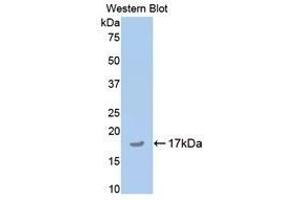 Western Blotting (WB) image for anti-Cartilage Oligomeric Matrix Protein (COMP) (AA 35-179) antibody (ABIN1174332) (COMP 抗体  (AA 35-179))