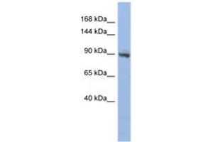 ZNF546 抗体  (AA 143-192)