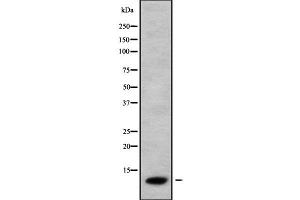 Western blot analysis of CCL26 using COLO205 whole cell lysates (CCL26 抗体  (Internal Region))