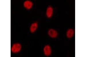 ABIN6275536 staining HepG2 by IF/ICC. (PLK5 抗体  (Internal Region))