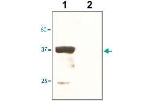 The tissue lysate derived from mouse kidney was immunoprobed by POU5F1 polyclonal antibody  at 1 : 500. (OCT4 抗体)