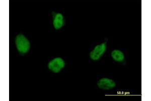 Immunofluorescence of purified MaxPab antibody to RUVBL2 on HeLa cell. (RUVBL2 抗体  (AA 1-463))