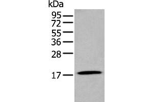 Western blot analysis of Human stomach tissue lysate using GKN2 Polyclonal Antibody at dilution of 1:250 (Gastrokine 2 抗体)