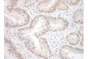 Immunohistochemistry (IHC) image for anti-RNA Binding Motif Protein 17 (RBM17) (AA 25-75) antibody (ABIN7448811) (RBM17 抗体  (AA 25-75))