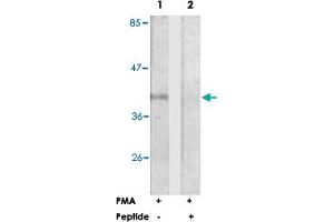 Western blot analysis of extracts from Jurkat cells, treated with PMA (125 ng/ml, 30 mins), using FCGR2B polyclonal antibody . (FCGR2B 抗体  (Ser363))