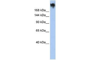 WB Suggested Anti-PKDREJ Antibody Titration:  0. (PKDREJ 抗体  (Middle Region))