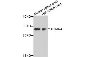Western blot analysis of extracts of various cell lines, using STMN4 antibody (ABIN5975820) at 1/1000 dilution. (STMN4 抗体)