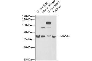 Western blot analysis of extracts of various cell lines, using MG antibody (ABIN6132348, ABIN6143808, ABIN6143810 and ABIN6222011) at 1:1000 dilution. (MGAT1 抗体  (AA 156-445))
