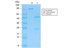 SDS-PAGE analysis of purified, BSA-free recombinant Cytokeratin 15 antibody (clone KRT15/2103R) as confirmation of integrity and purity. (KRT15 抗体)