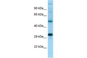 Western Blotting (WB) image for anti-NDRG Family Member 4 (NDRG4) (C-Term) antibody (ABIN2789943) (NDRG4 抗体  (C-Term))