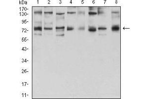 Western blot analysis using GFPT1 mouse mAb against Hela (1), HepG2 (2), HEK293 (3), BEL-7402 (4), SMMC-7721 (5), SK-MES-1 (6), C6 (7), and COS7 (8) cell lysate. (GFPT1 抗体  (AA 536-681))