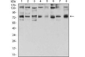 Western blot analysis using GFPT1 mouse mAb against Hela (1), HepG2 (2), HEK293 (3), BEL-7402 (4), SMMC-7721 (5), SK-MES-1 (6), C6 (7), and COS7 (8) cell lysate. (GFPT1 抗体  (AA 536-681))