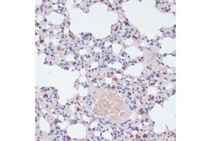 Immunohistochemistry (IHC) image for anti-Lysozyme (LYZ) (AA 1-100) antibody (ABIN6143409)