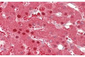 Immunohistochemistry (IHC) image for anti-Alanine Aminotransferase (ALT) (AA 147-263) antibody (ABIN7438472)