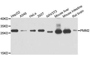 Western blot analysis of extracts of various cell lines, using PMM2 antibody. (PMM2 抗体  (AA 1-246))