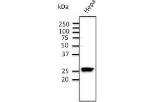 Anti-Rab11 Ab  at 1/500 dilution;  Hepa cell line at 100 µg per lane; rabbit polyclonal to goat lgG (HRP) at 1/10. (RAB11A 抗体  (C-Term))