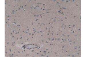 IHC-P analysis of Human Brain Tissue, with DAB staining. (ABCC8 抗体  (AA 679-929))