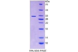 SDS-PAGE analysis of Human RARb Protein. (Retinoic Acid Receptor beta 蛋白)