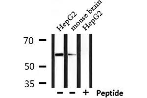Western blot analysis of extracts from mouse brain and HepG2, using Caspase 10 Antibody. (Caspase 10 抗体)