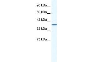 WB Suggested Anti-MTA1 Antibody Titration:  2. (MTA1 抗体  (C-Term))