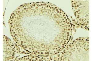 ABIN6276851 at 1/100 staining Mouse testis tissue by IHC-P. (LIG4 抗体  (C-Term))