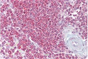 Immunohistochemistry with Spleen tissue at an antibody concentration of 5µg/ml using anti-RPSA antibody (ARP54683_P050) (RPSA/Laminin Receptor 抗体  (Middle Region))