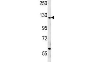 CUX1 antibody western blot analysis in MCF-7 lysate (CUX1 抗体  (AA 1347-1374))